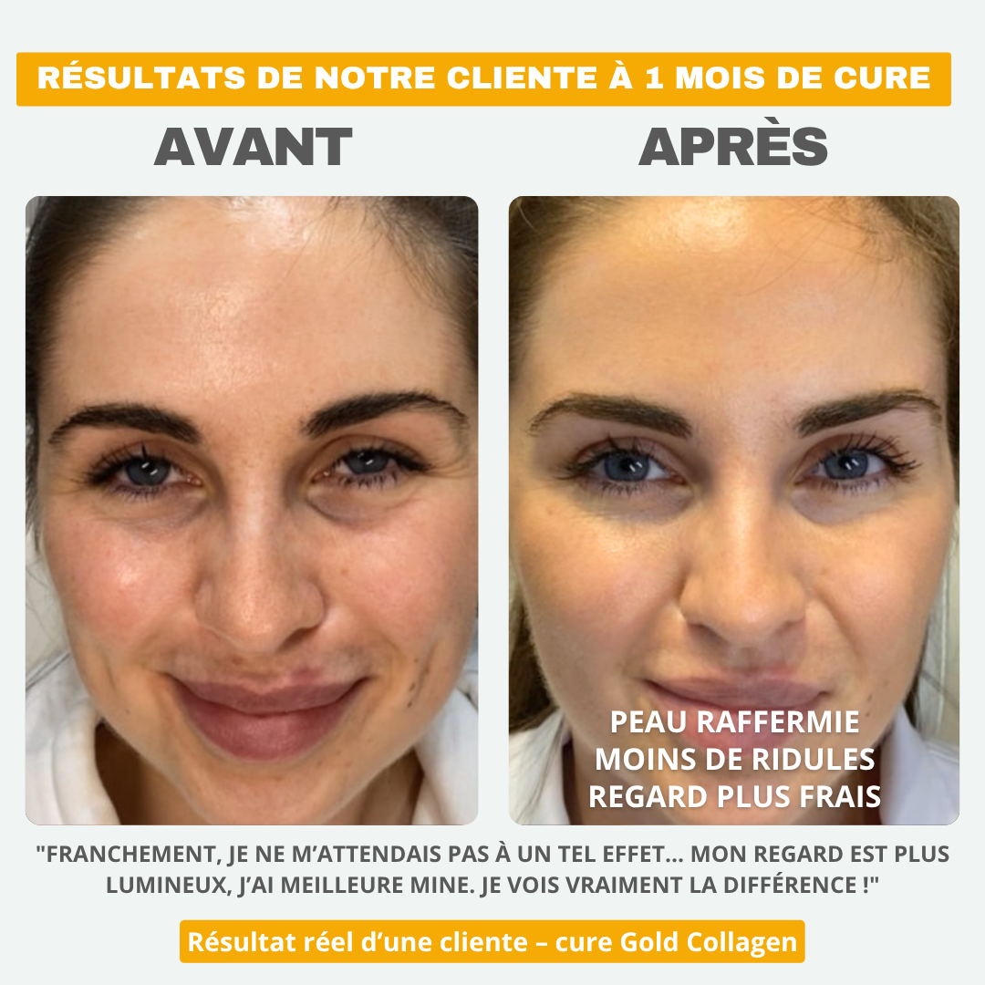 Patchs Gold Collagen - Fermeté & Lissage