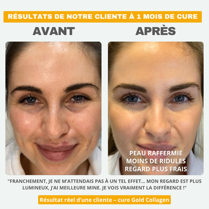 Patchs Gold Collagen - Fermeté & Lissage